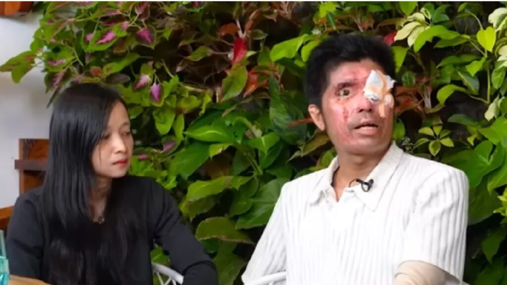 Istri Agus Salim Korban Air Keras Diduga Tilap Uang Donasi