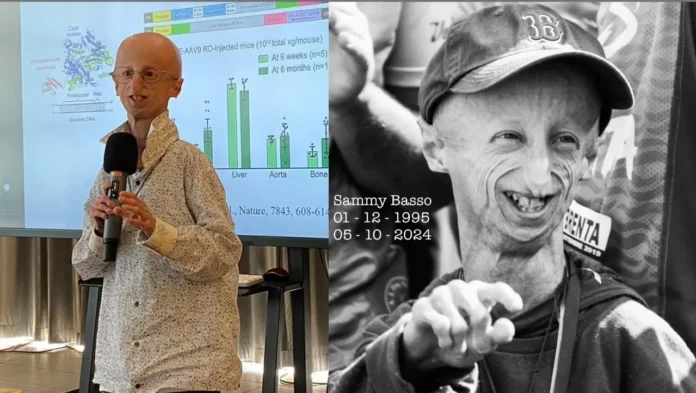 Sammy Basso Penderita Progeria Meninggal Dunia di Usia 28 Tahun