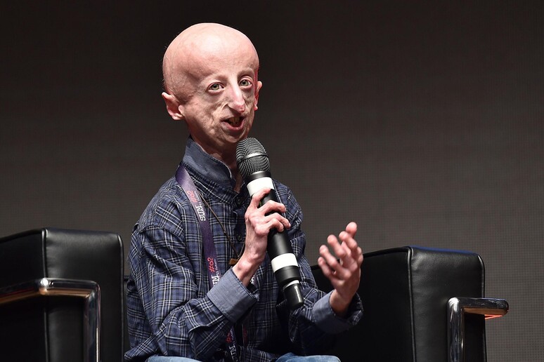 Sammy Basso Penderita Progeria Meninggal Dunia di Usia 28 Tahun