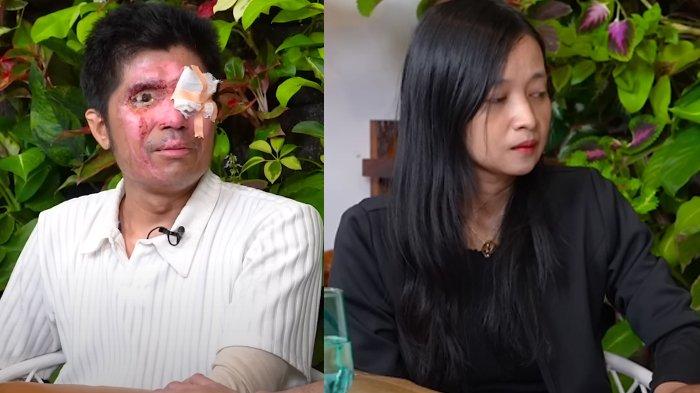 Istri Agus Salim Korban Air Keras Diduga Tilap Uang Donasi