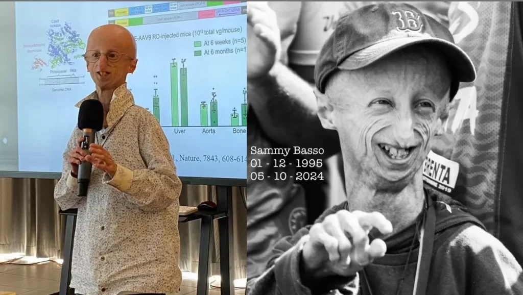 Sammy Basso Penderita Progeria Meninggal Dunia di Usia 28 Tahun